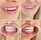 Slider image (9) Astra Dental Clinic